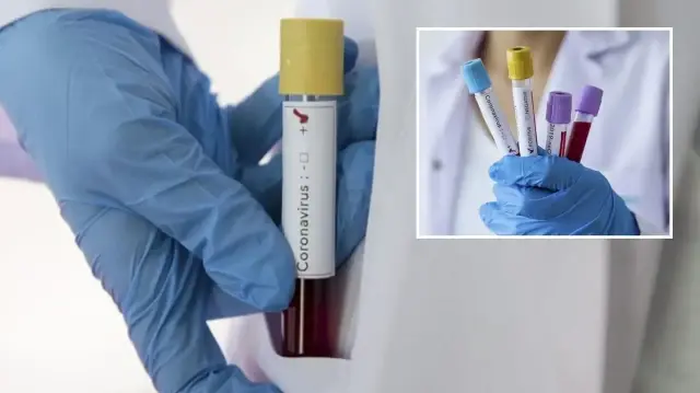 zayiflar kovid 19u daha agir geciriyor 7mN8SZGl.webp